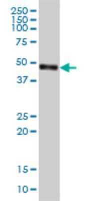 Western Blot: CPVL Antibody (2G5-1C1) [H00054504-M01]