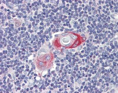 Immunohistochemistry: CPXCR1 Antibody [NBP1-80386]