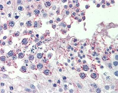 Immunohistochemistry: CPXCR1 Antibody [NBP1-80386]