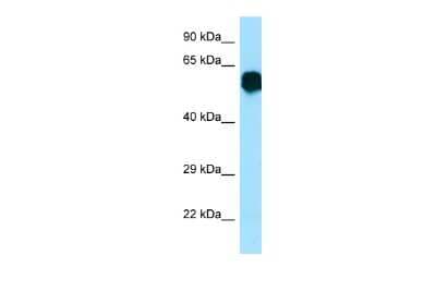 Western Blot: CR1L Antibody [NBP3-09478]