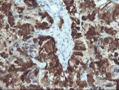 Immunohistochemistry-Paraffin: CRABP2 Antibody (OTI10D6) [NBP2-03807]