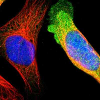 Immunocytochemistry/ Immunofluorescence: CRABP2 Antibody [NBP1-85465]