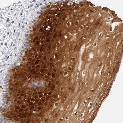 Immunohistochemistry-Paraffin: CRABP2 Antibody [NBP1-85465]
