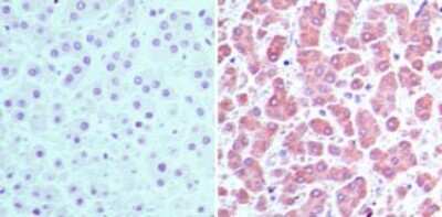 Immunohistochemistry-Paraffin: CRABP2 Antibody [NBP2-24764]