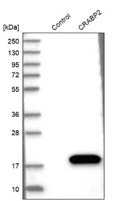 Western Blot: CRABP2 Antibody [NBP1-85465]