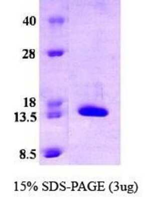 SDS-PAGE: Recombinant Human CRABP2 Protein [NBC1-18490]