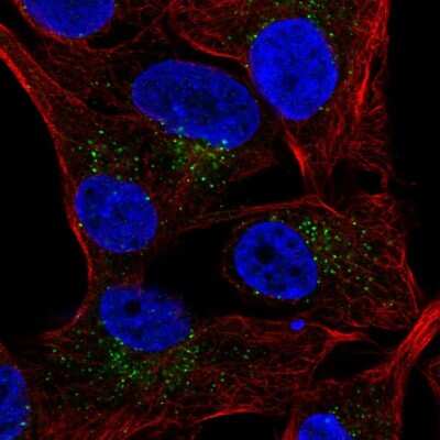 Immunocytochemistry/ Immunofluorescence: CRACC/SLAMF7 Antibody [NBP2-55899]