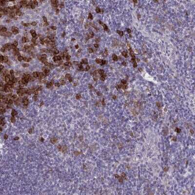 Immunohistochemistry-Paraffin: CRACC/SLAMF7 Antibody [NBP2-37951]