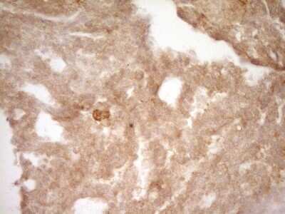 Immunohistochemistry: CRACC/SLAMF7 Antibody (OTI1F1) [NBP2-45868]