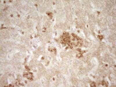 Immunohistochemistry: CRACC/SLAMF7 Antibody (OTI1F1) [NBP2-45868]