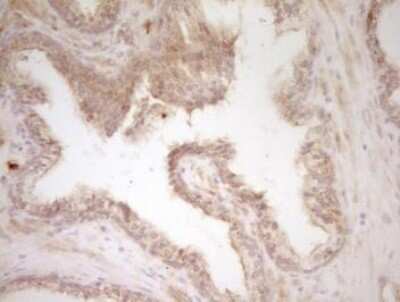 Immunohistochemistry-Paraffin: CRACC/SLAMF7 Antibody (OTI1F1) [NBP2-45868]