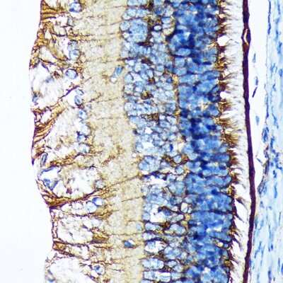 Immunohistochemistry-Paraffin: CRALBP Antibody (2M0G2) [NBP3-16798]