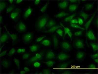 Immunocytochemistry/ Immunofluorescence: CRALBP Antibody (4H5) [H00006017-M02]