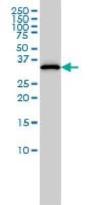Western Blot: CRALBP Antibody (4H5) [H00006017-M02]