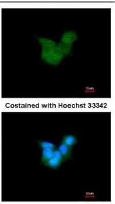 Immunocytochemistry/ Immunofluorescence: CRALBP Antibody [NBP1-31770]