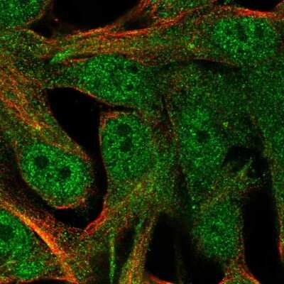 Immunocytochemistry/ Immunofluorescence: CRALBP Antibody [NBP2-58065]
