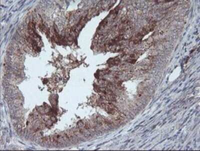 Immunohistochemistry: CRALBP Antibody (OTI1G6) - Azide and BSA Free [NBP2-71275]