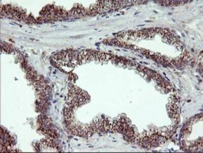 Immunohistochemistry: CRALBP Antibody (OTI1G6) - Azide and BSA Free [NBP2-71275]