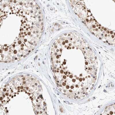 Immunohistochemistry-Paraffin: CRAT Antibody [NBP1-86615]