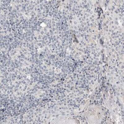 Immunohistochemistry-Paraffin: CRAT Antibody [NBP1-86615]