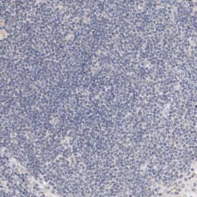 Immunohistochemistry-Paraffin: CRAT Antibody [NBP1-86616]