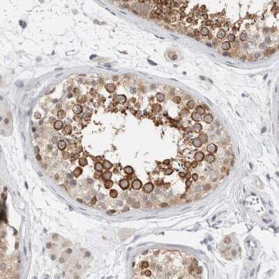 Immunohistochemistry-Paraffin: CRAT Antibody [NBP1-86616]