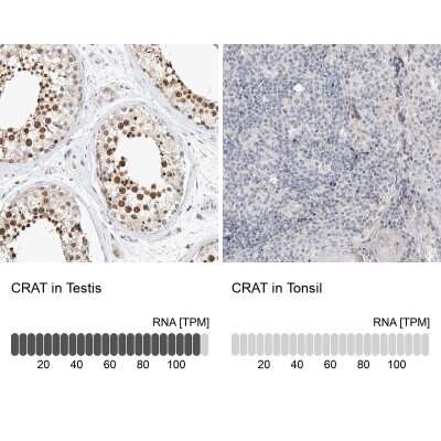 Western Blot: CRAT Antibody [NBP1-86615]