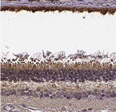 Immunohistochemistry-Paraffin: CRB1 Antibody [NBP2-56113]