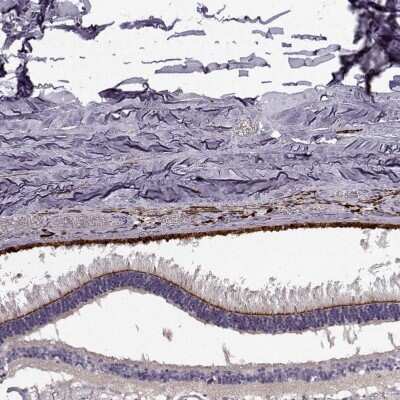 Immunohistochemistry-Paraffin: CRB2 Antibody [NBP1-91809]