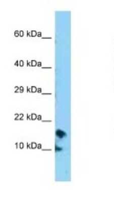 Western Blot: CRB3 Antibody [NBP1-98328]