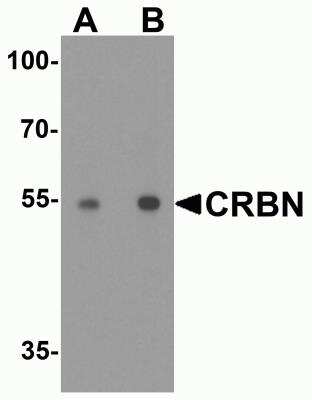 Western Blot: CRBN AntibodyBSA Free [NBP2-82079]