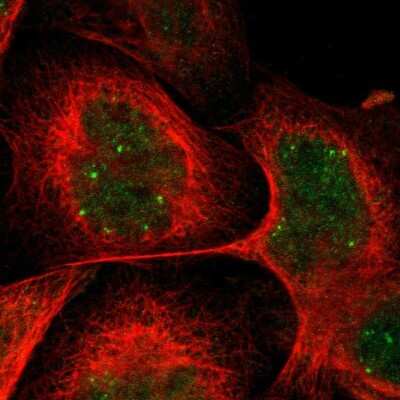 Immunocytochemistry/ Immunofluorescence: CRCP Antibody [NBP1-84495]