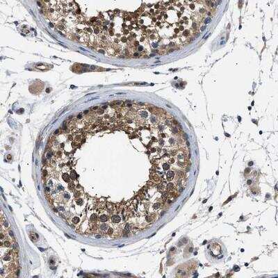 Immunohistochemistry-Paraffin: CRCP Antibody [NBP1-84495]