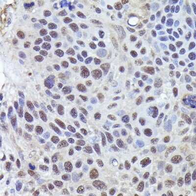 Immunohistochemistry-Paraffin: CRCP Antibody - Azide and BSA Free [NBP2-92783]