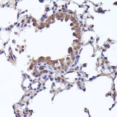 Immunohistochemistry-Paraffin: CRCP Antibody - Azide and BSA Free [NBP2-92783]