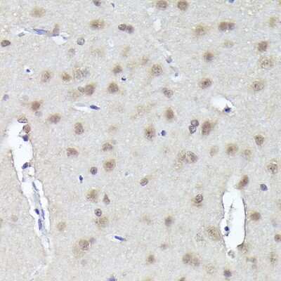 Immunohistochemistry-Paraffin: CRCP Antibody - Azide and BSA Free [NBP2-92783]
