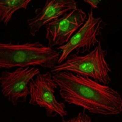 Immunocytochemistry/ Immunofluorescence: CREB Antibody (5G3) - BSA Free [NBP2-37610]