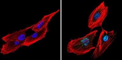 Immunocytochemistry/ Immunofluorescence: CREB Antibody [NBP2-22516]