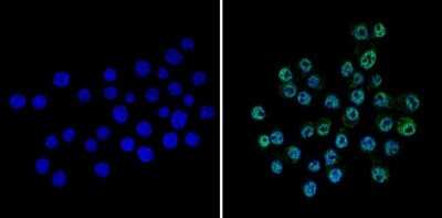 Immunocytochemistry/ Immunofluorescence: CREB Antibody [NBP2-22516]