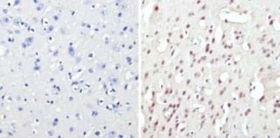 Immunohistochemistry-Paraffin: CREB Antibody [NBP2-22516]