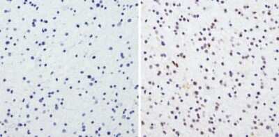 Immunohistochemistry-Paraffin: CREB Antibody [NBP2-22516]