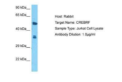 Western Blot: CREB3 regulatory factor Antibody [NBP1-79997]