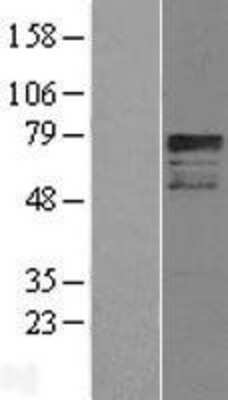 Western Blot: OASIS/CREB3L1 Overexpression Lysate [NBL1-09464]