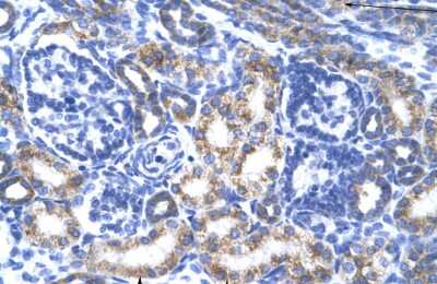 Immunohistochemistry: CREB3L2 Antibody [NBP2-87208]