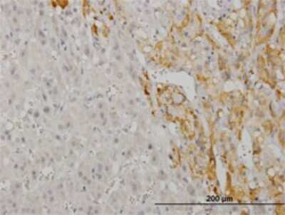 Immunohistochemistry-Paraffin: CREB5 Antibody (8A5) [H00009586-M02]