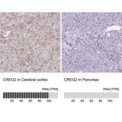 Immunohistochemistry-Paraffin: CREG2 Antibody [NBP1-86262]