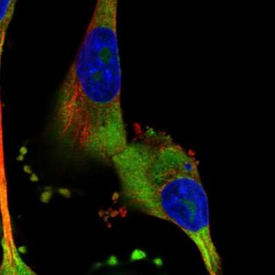 Immunocytochemistry/ Immunofluorescence: CRELD1 Antibody [NBP1-88917]
