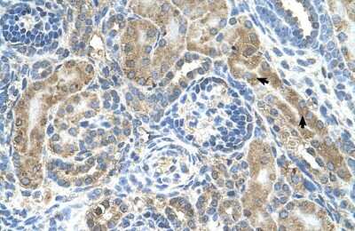 Immunohistochemistry-Paraffin: CRELD1 Antibody [NBP1-59928]