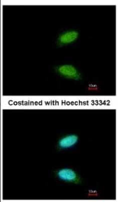 Immunocytochemistry/ Immunofluorescence: CREM Antibody [NBP2-16009]