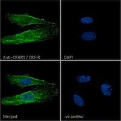 Immunocytochemistry/ Immunofluorescence: CRHR1/CRF1 Antibody [NBP1-00175]